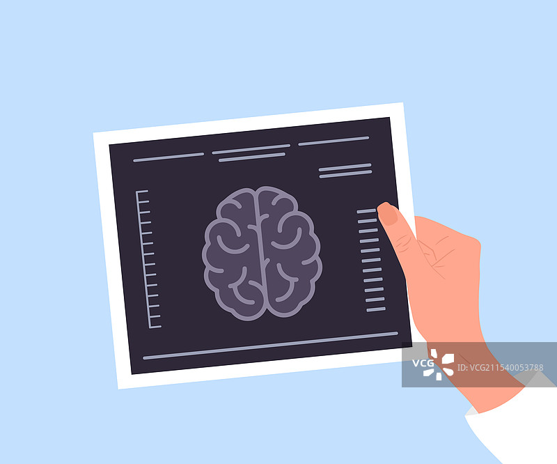 女性手持磁共振扫描结果图片素材