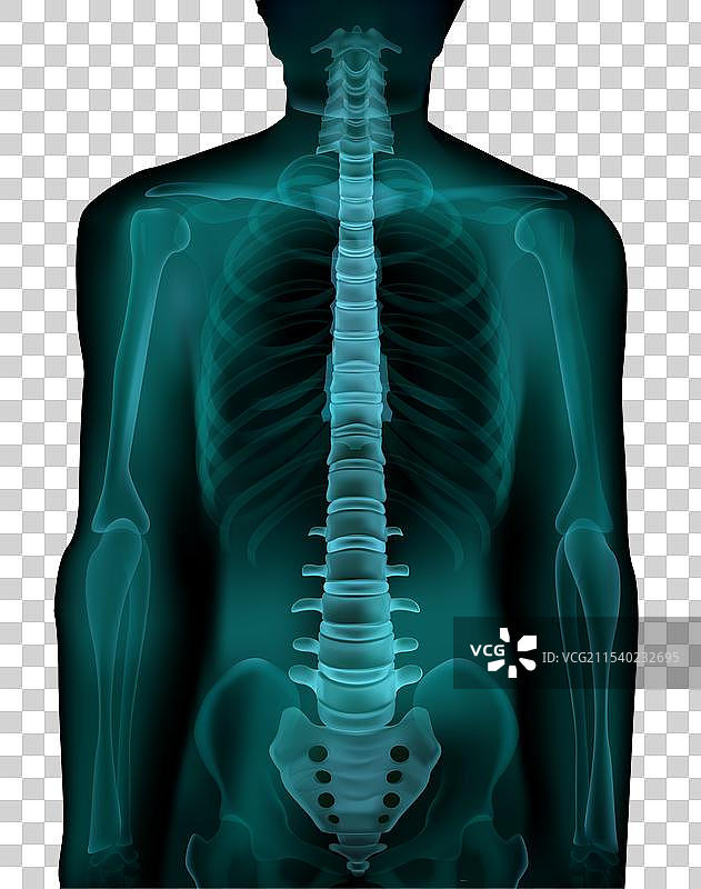 脊柱X光真实图像图片素材