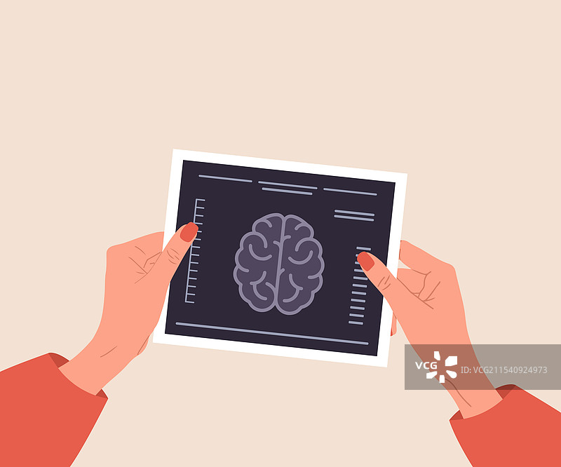 神经科医生概念，女性手握着结果图片素材