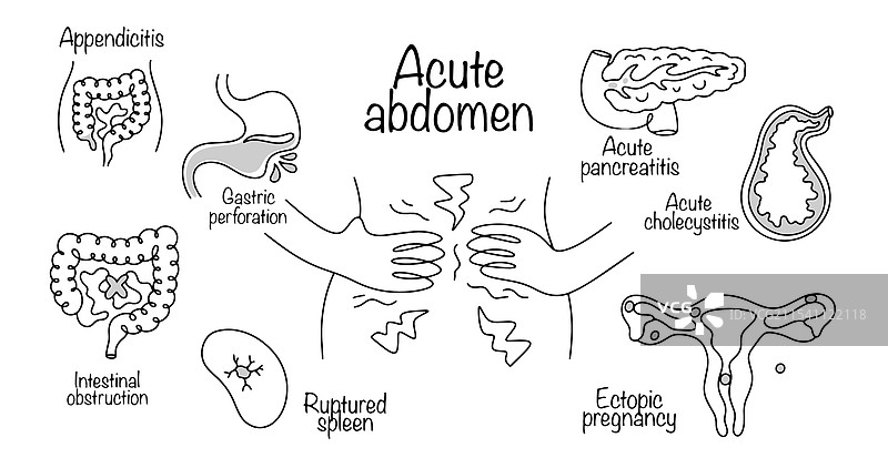 急性腹痛图片素材