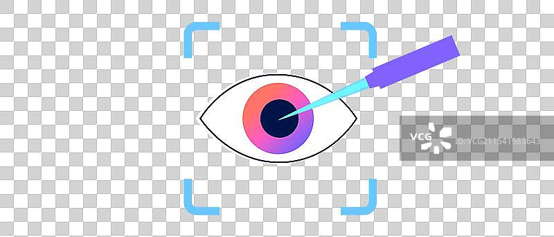 激光矫正视力手术图片素材