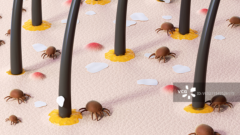 头皮螨虫头皮屑控油图片素材