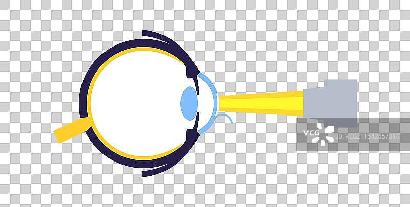 激光矫正视力手术图片素材