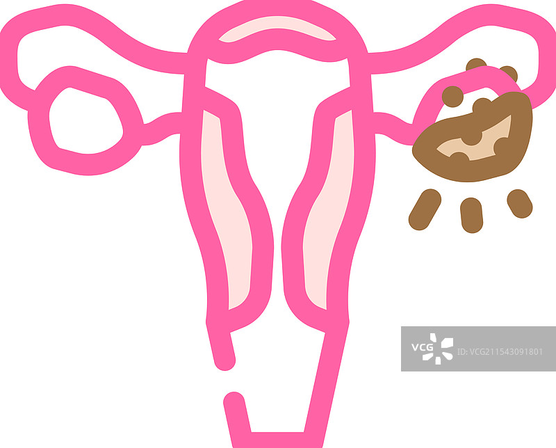 卵巢癌女性疾病彩色图标图片素材