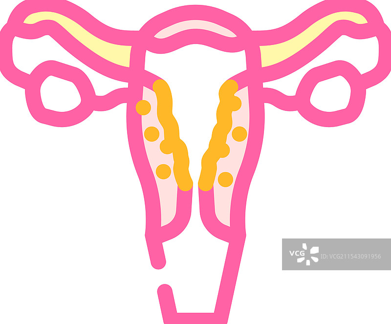 盆腔炎女性疾病彩色图标图片素材