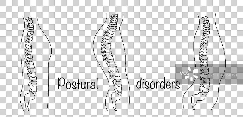 姿势障碍图片素材