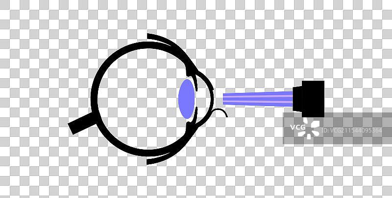 激光矫正视力手术图片素材