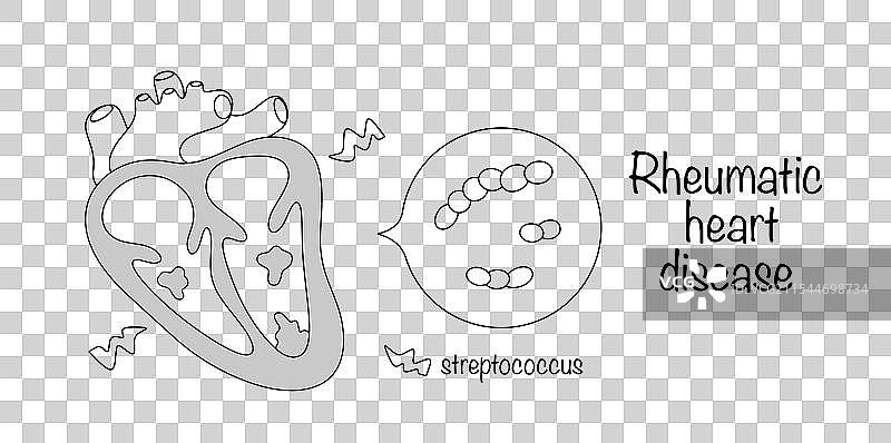 风湿性心脏病图片素材