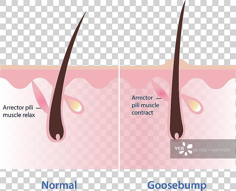 皮肤上的鸡皮疙瘩图片素材