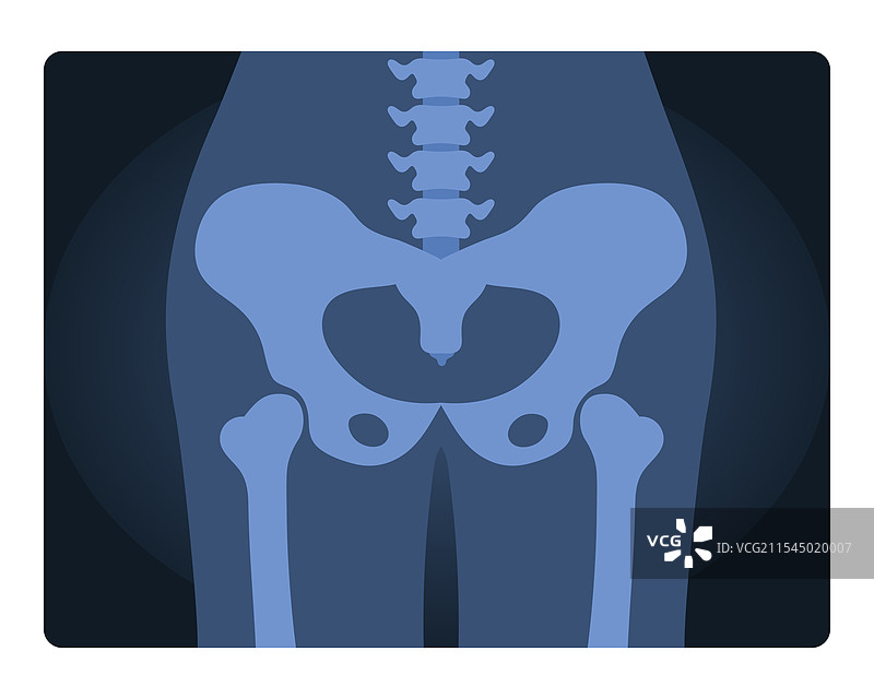 人类骨盆的X光片图片素材