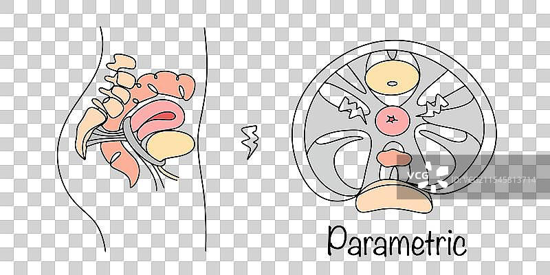 参数化的图片素材