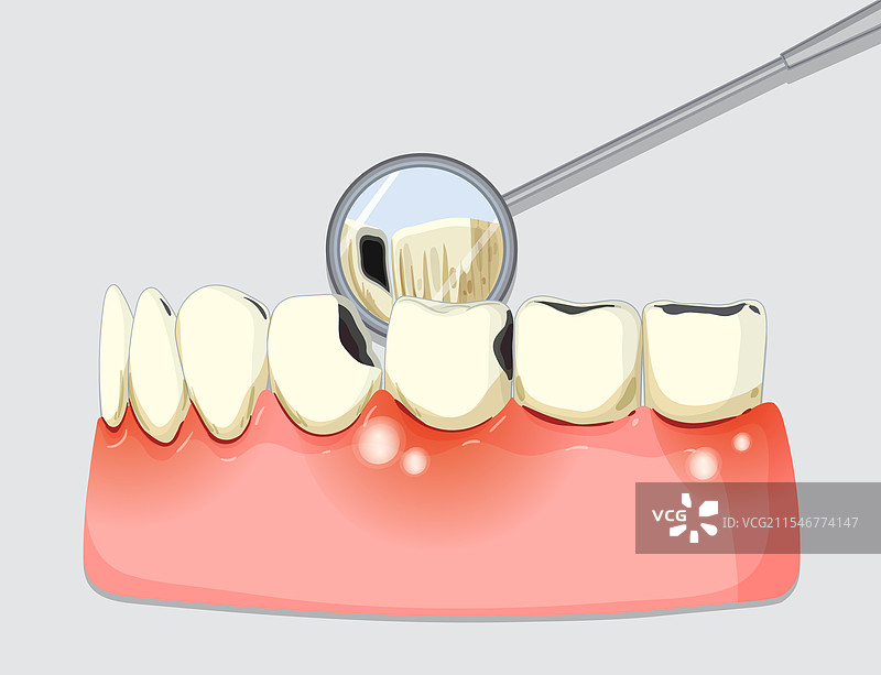 牙齿和牙科检查工具图片素材