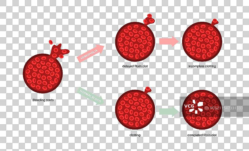 血友病医学海报图片素材