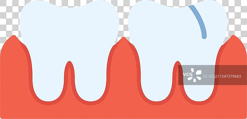 牙龈炎扁平图标设计图片素材