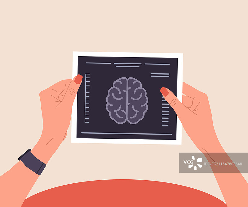 女性手持X光结果的MRI扫描图片素材