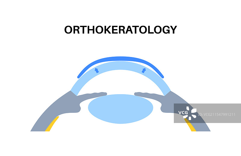 正视角接触镜图片素材