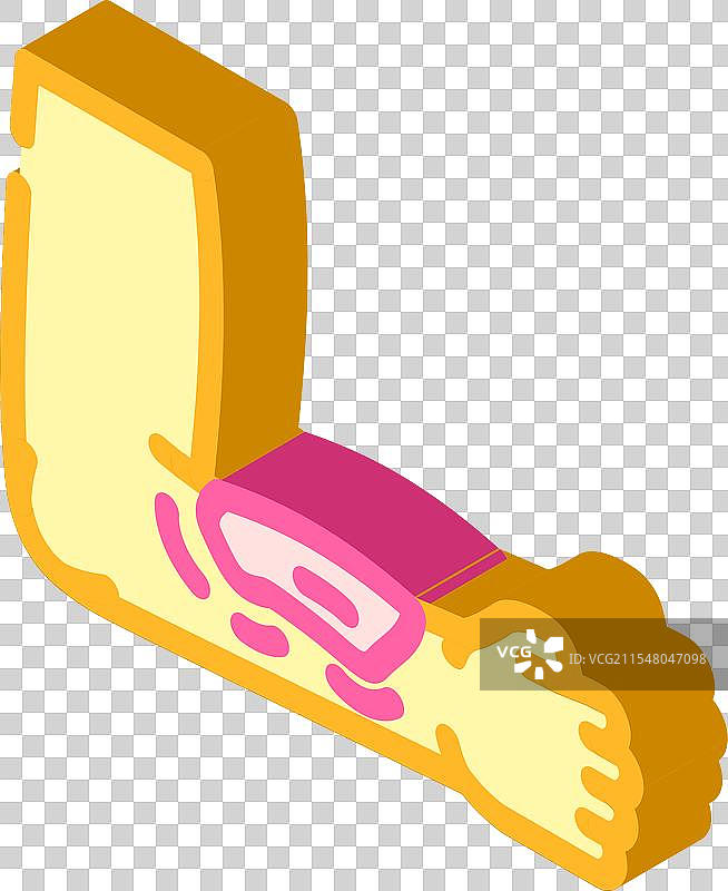 淤伤 家庭受伤 事故 等距图标图片素材