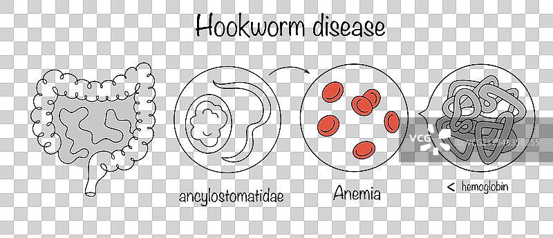 钩虫病图片素材