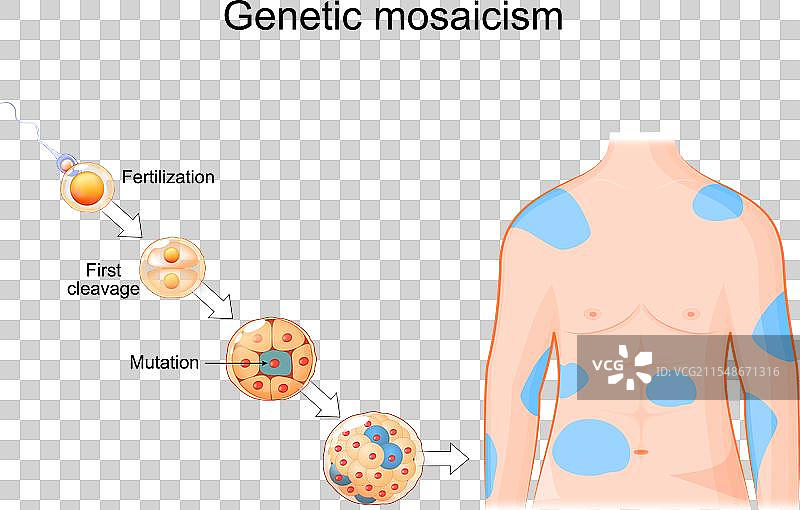 遗传马赛克体细胞突变图片素材