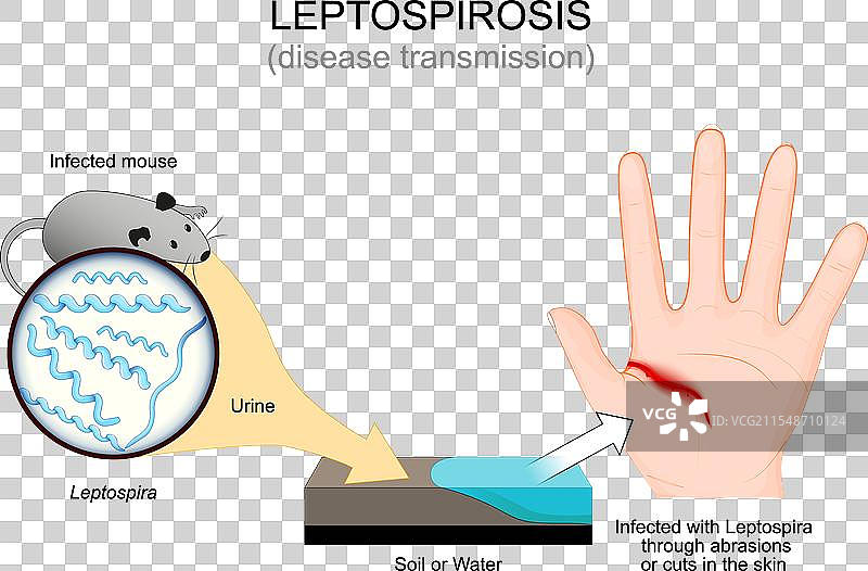 钩端螺旋体病的传播途径来自感染者图片素材