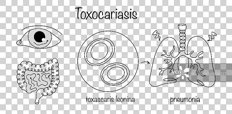 弓形虫病图片素材