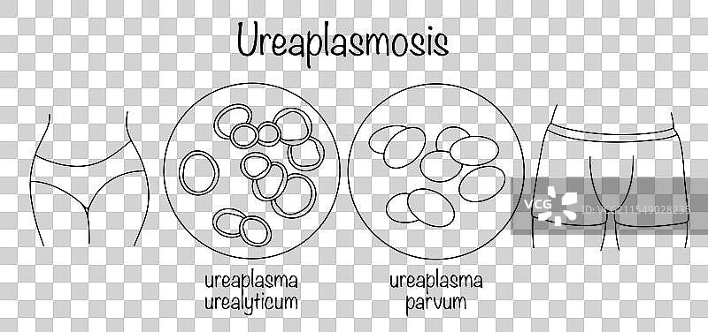 尿道炎症图片素材