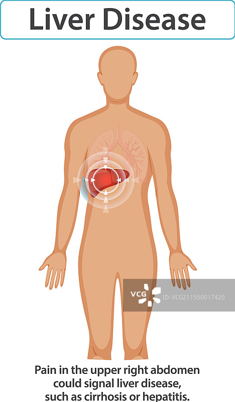 突出肝病的症状和原因图片素材