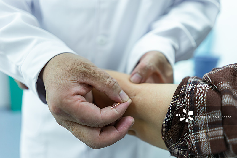 中国中医药服务拍摄主题，中医医院医生正在给病人患者后背火疗针灸拔罐，室内无人图像摄影图片素材