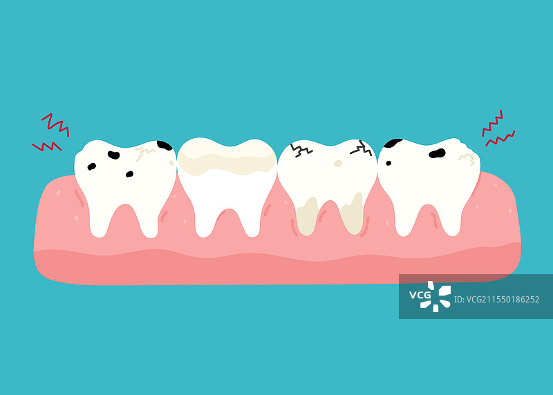 患有龋齿的病牙图片素材