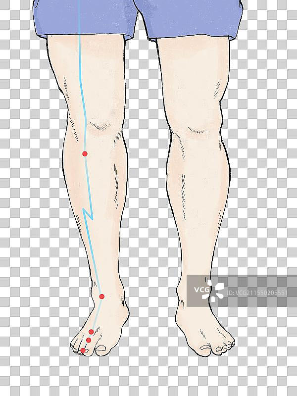 插画-中医穴位足阳明胃经腿部针灸图片素材
