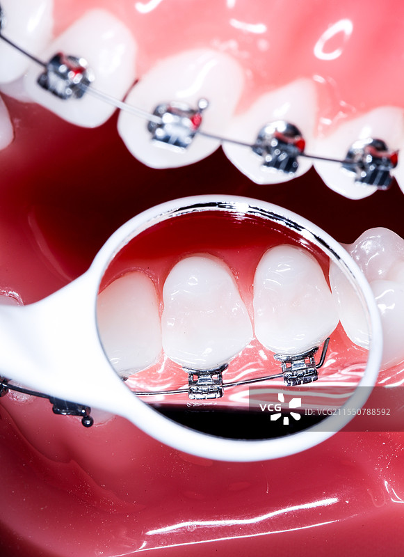 镜子里的托槽图片素材