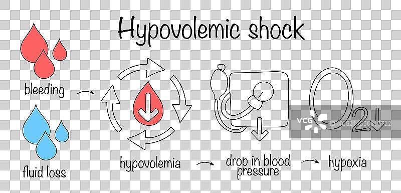 低血容量性休克图片素材