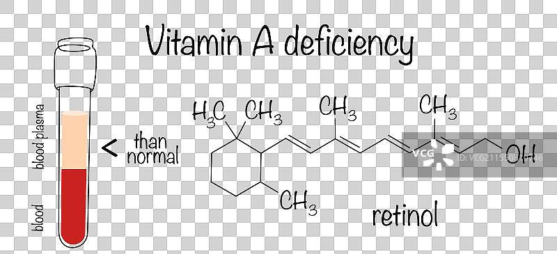 维生素A缺乏症图片素材