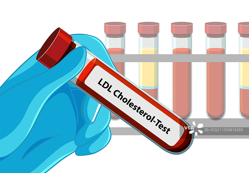 实验室中的低密度脂蛋白胆固醇测试图片素材