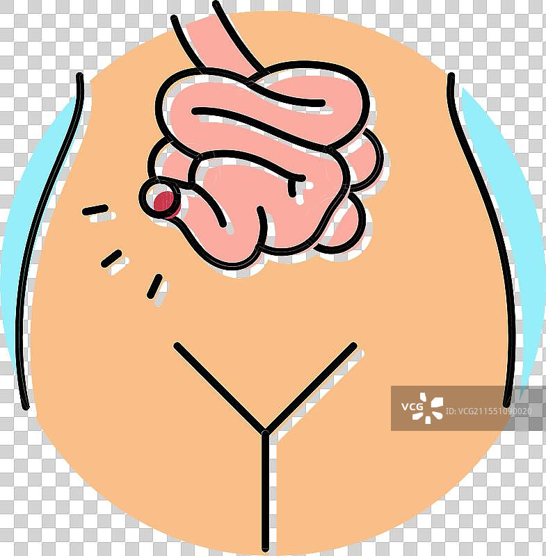 回肠造口手术医生 彩色图标图片素材