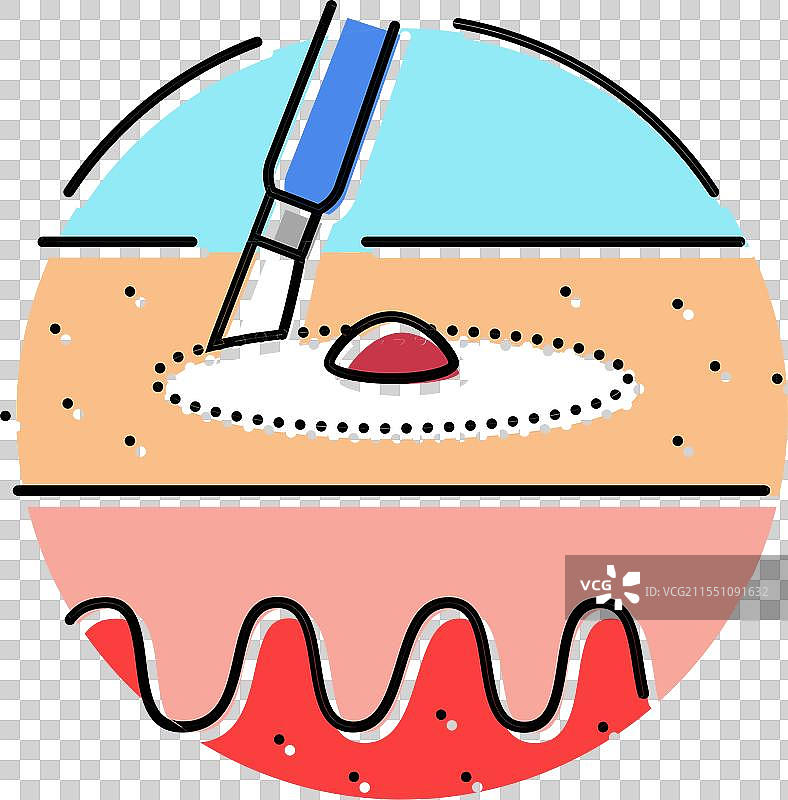 扩张和刮宫手术彩色图标图片素材