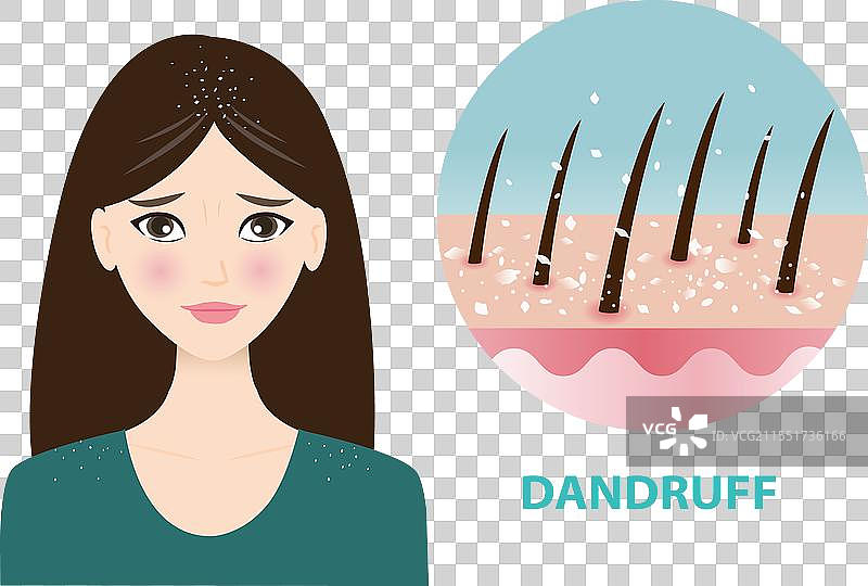 女性与头皮屑图标的信息图表图片素材