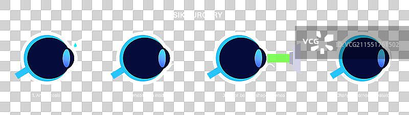 激光矫正视力手术图片素材