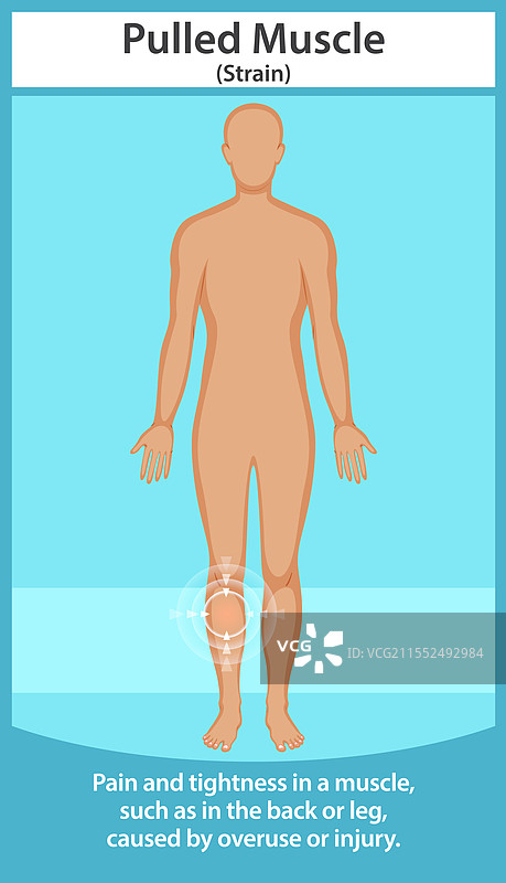 人体肌肉拉伤图片素材