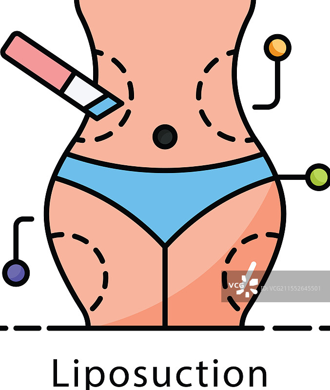 彩色抽脂术等距图图片素材