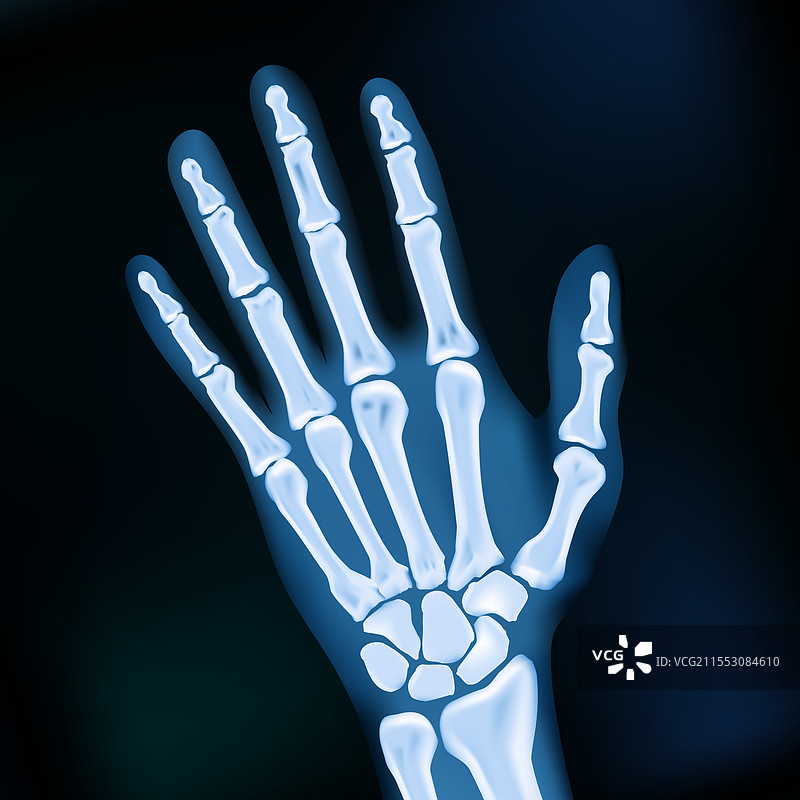 逼真的2D手部X光暗色医学图像图片素材