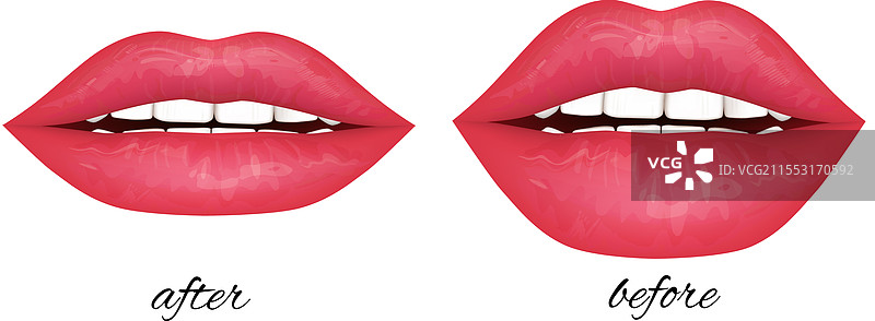 美学唇部增强设计前后对比图片素材