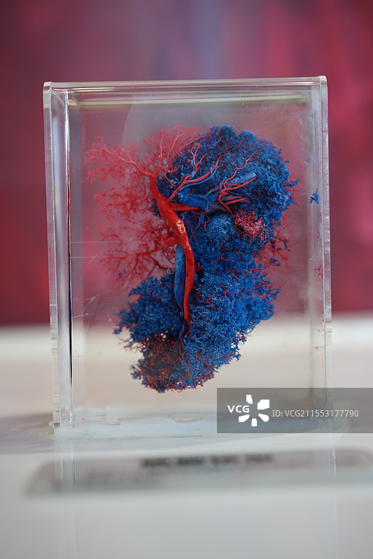 肾脏铸型图片素材