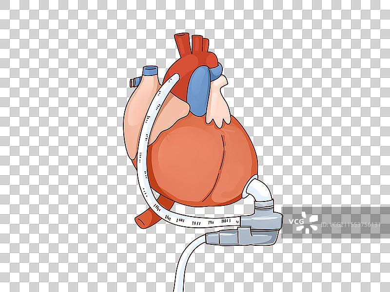 人工心脏图片素材