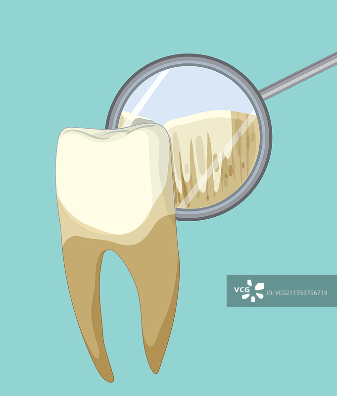 蓝色背景上的牙齿与牙科镜图片素材