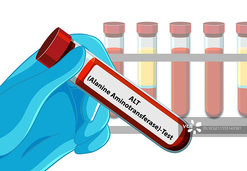手持血样进行ALT测试图片素材