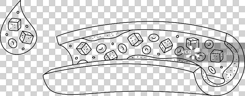 糖尿病血管图片素材