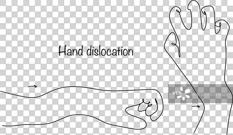 脱臼的手腕图片素材
