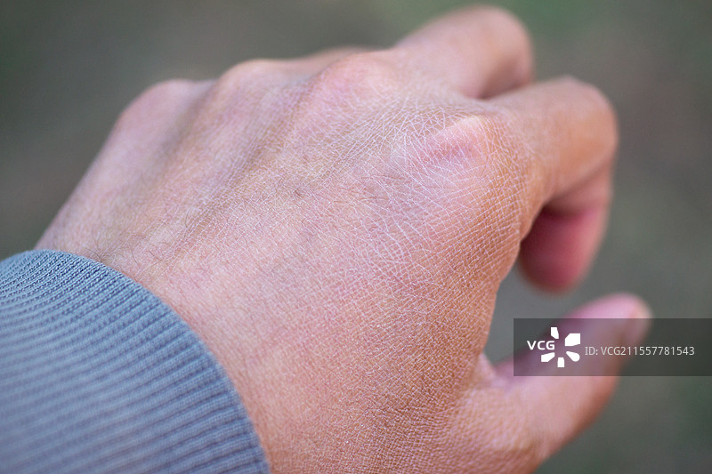 春天户外干燥粗糙的男人手背，手部微距特写，干燥天气皮肤保湿，环境气候身体健康图片素材