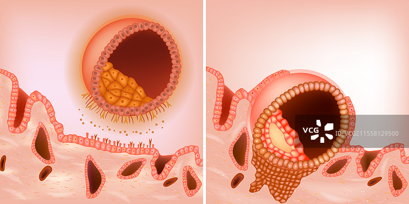 胚胎植入过程图片素材